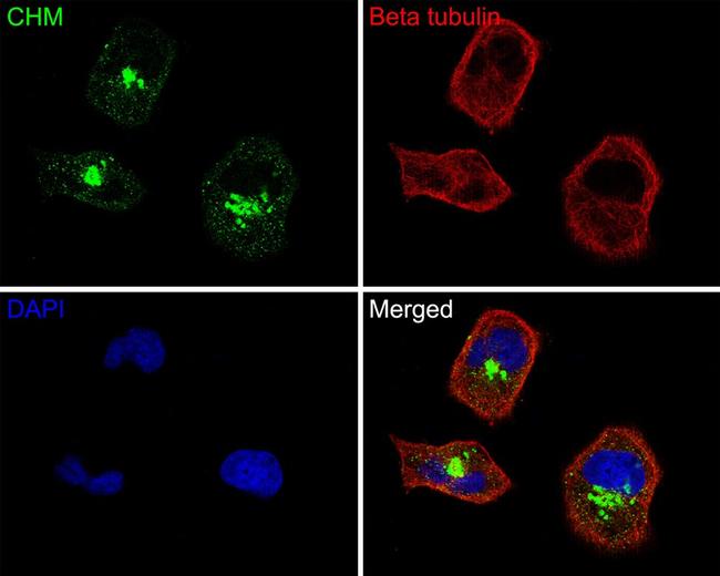 CHM Antibody in Immunocytochemistry (ICC/IF)