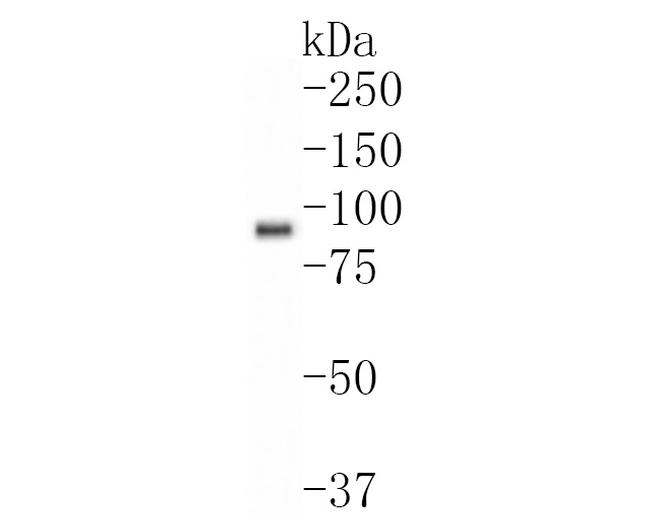 PPM1E Antibody in Western Blot (WB)