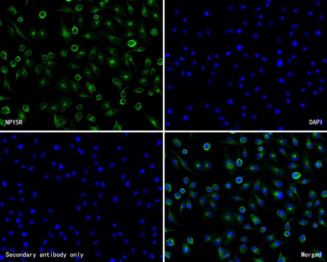 NPY5R Antibody in Immunocytochemistry (ICC/IF)