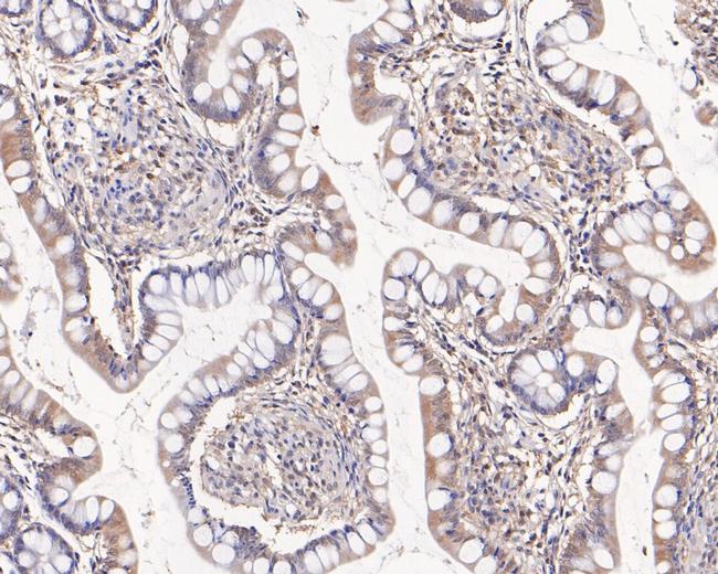 HOOK2 Antibody in Immunohistochemistry (Paraffin) (IHC (P))