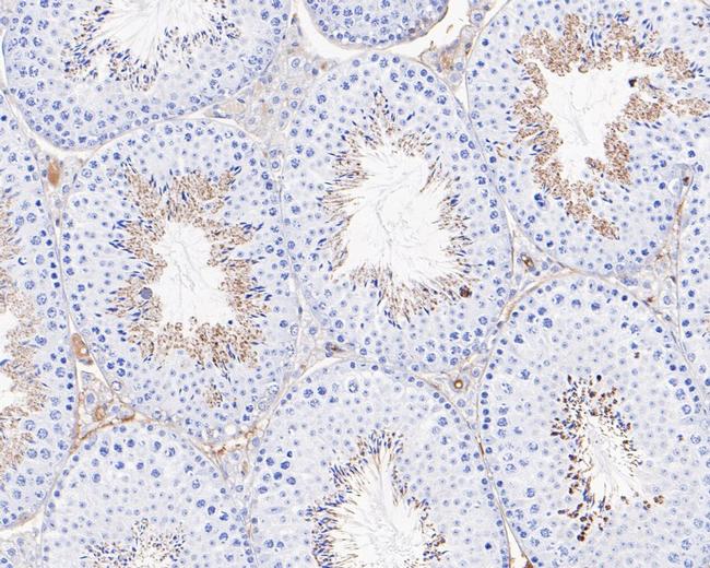 MC5R Antibody in Immunohistochemistry (Paraffin) (IHC (P))