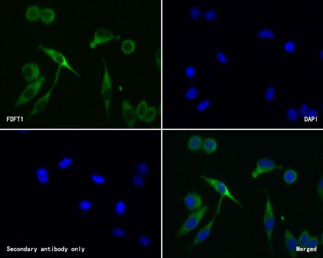 FDFT1 Antibody in Immunocytochemistry (ICC/IF)