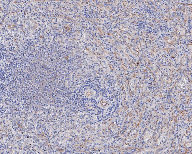 CD84 Antibody in Immunohistochemistry (Paraffin) (IHC (P))