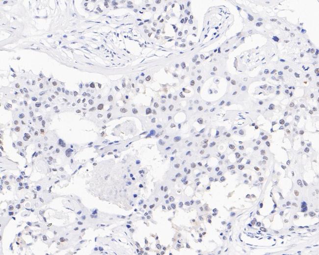 USP39 Antibody in Immunohistochemistry (Paraffin) (IHC (P))