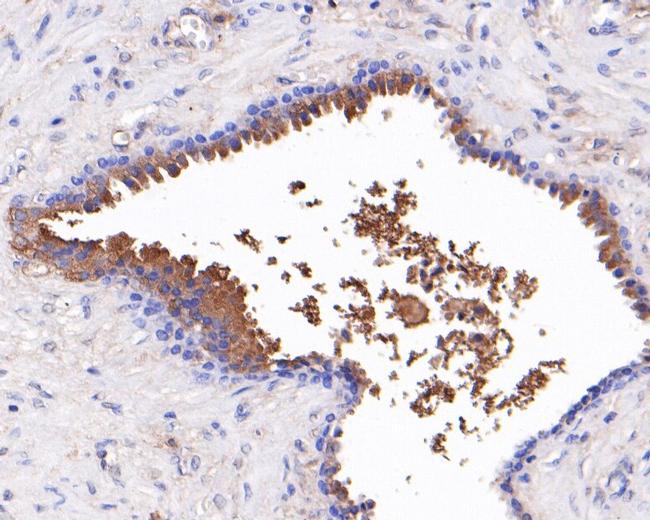 ACAT2 Antibody in Immunohistochemistry (Paraffin) (IHC (P))