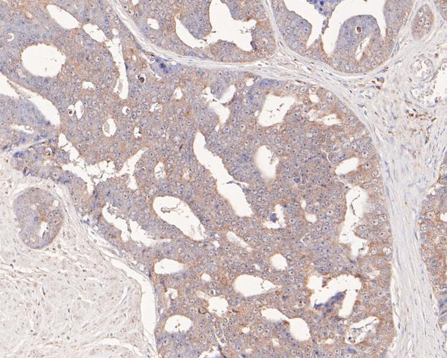 FKTN Antibody in Immunohistochemistry (Paraffin) (IHC (P))