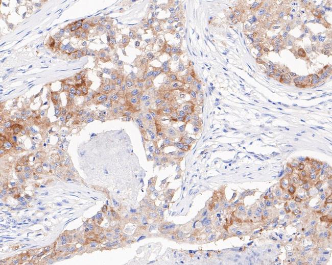 ZPR1 Antibody in Immunohistochemistry (Paraffin) (IHC (P))