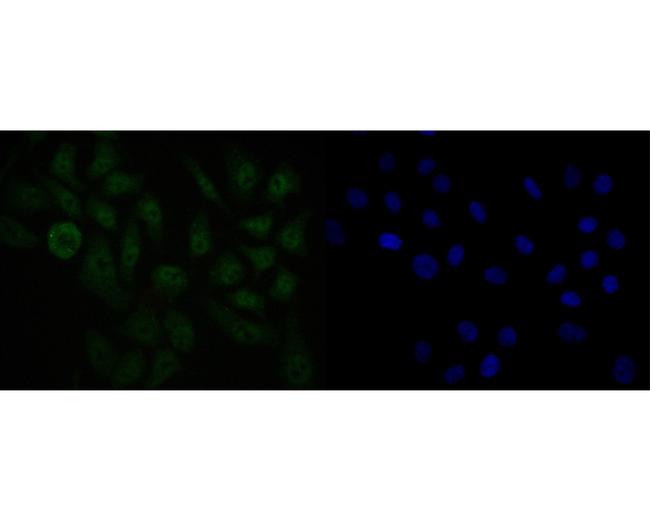 USP24 Antibody in Immunocytochemistry (ICC/IF)