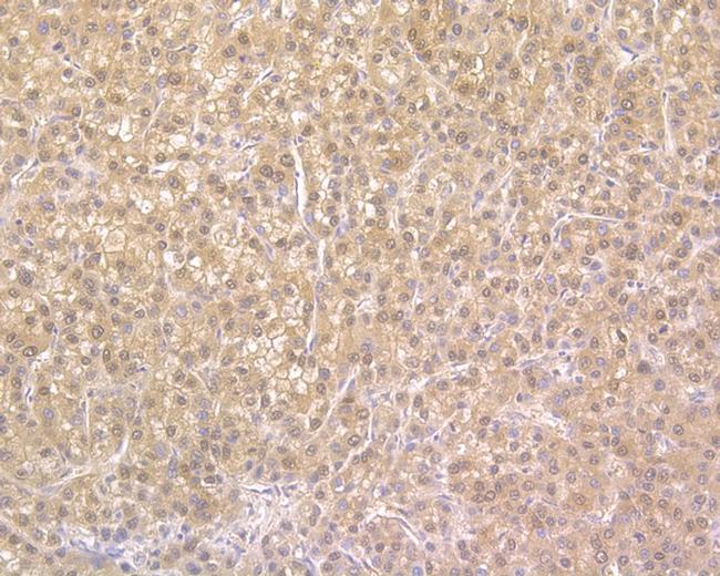 NUDT5 Antibody in Immunohistochemistry (Paraffin) (IHC (P))