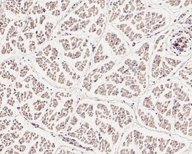 WIPI1 Antibody in Immunohistochemistry (Paraffin) (IHC (P))