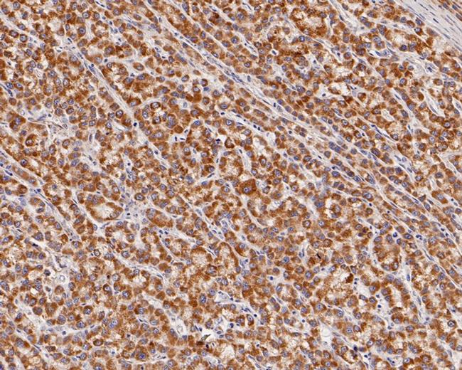 SUOX Antibody in Immunohistochemistry (Paraffin) (IHC (P))