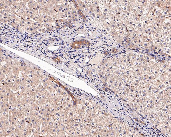 ACSL3 Antibody in Immunohistochemistry (Paraffin) (IHC (P))