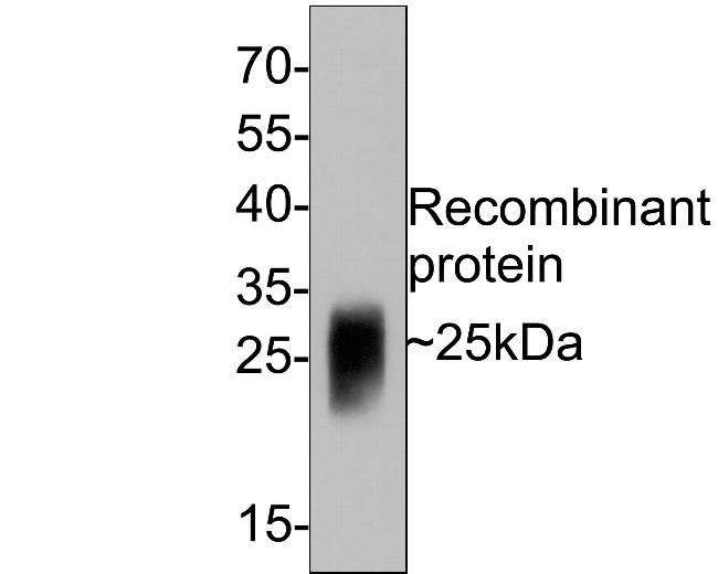 GM-CSF Antibody in Western Blot (WB)