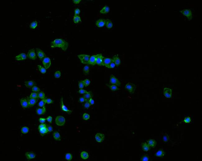 TROP2 Antibody in Immunocytochemistry (ICC/IF)