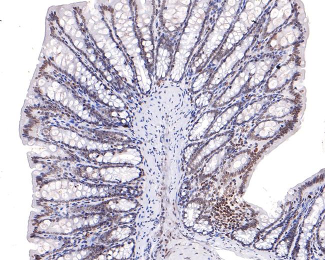 RUNX3 Antibody in Immunohistochemistry (Paraffin) (IHC (P))