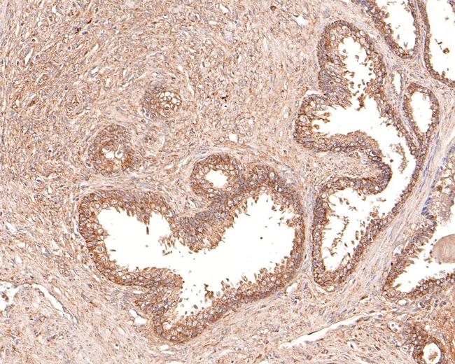 IL11RA Antibody in Immunohistochemistry (Paraffin) (IHC (P))