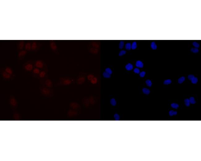 SIRT1 Antibody in Immunocytochemistry (ICC/IF)