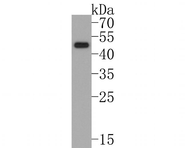 FOXA2 Antibody in Western Blot (WB)