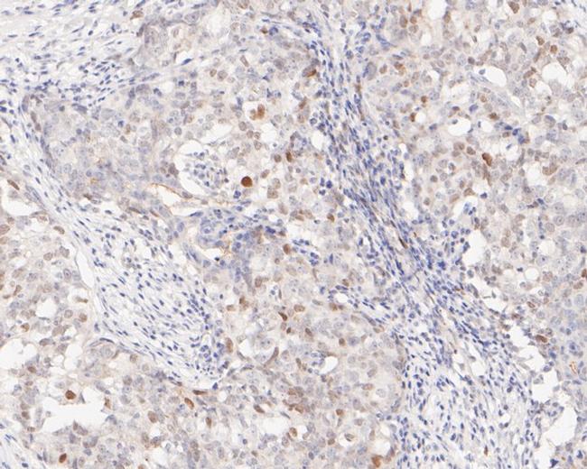 Phospho-STAT5 alpha (Tyr694) Antibody in Immunohistochemistry (Paraffin) (IHC (P))