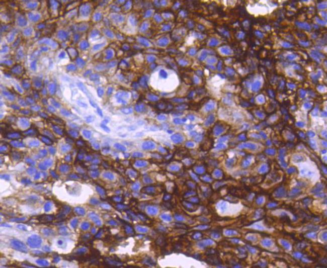 EpCAM Antibody in Immunohistochemistry (Paraffin) (IHC (P))