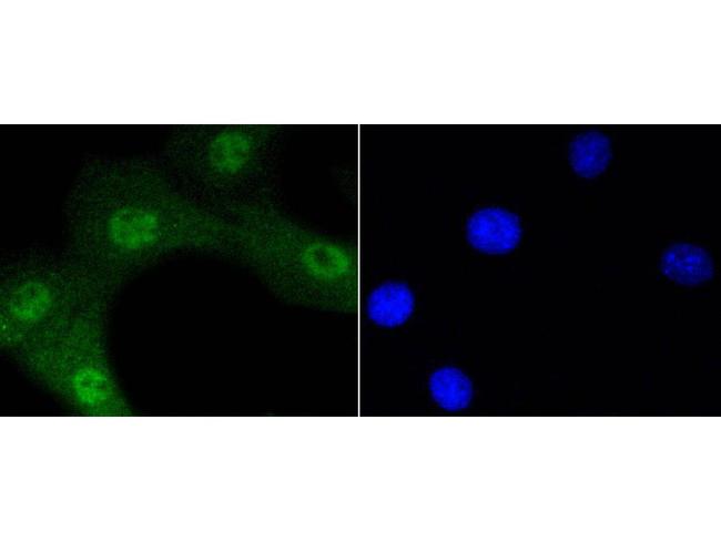 Phospho-AKT1 (Ser473) Antibody in Immunocytochemistry (ICC/IF)