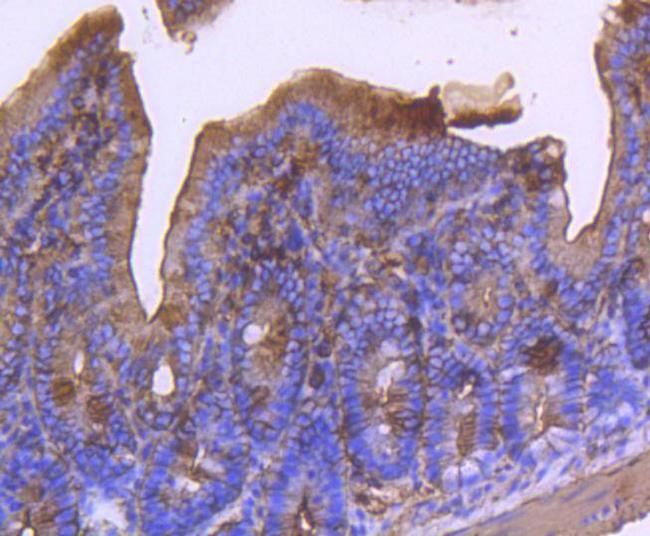 Alpha-Smooth Muscle Actin Antibody in Immunohistochemistry (Paraffin) (IHC (P))