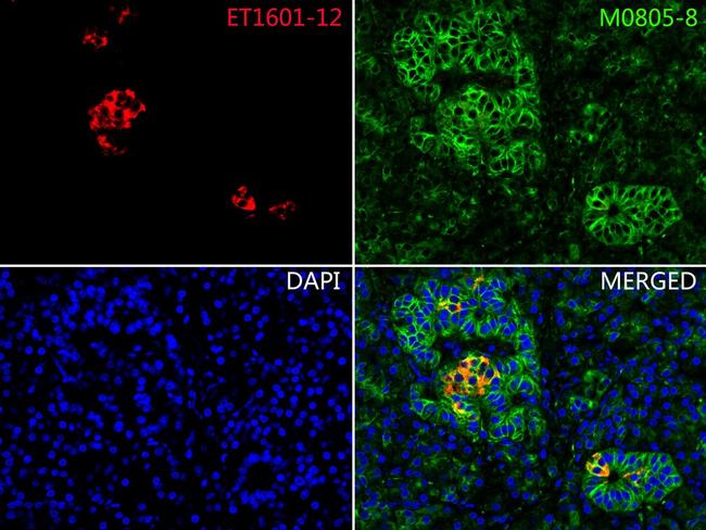 Insulin Antibody in Immunohistochemistry (Paraffin) (IHC (P))