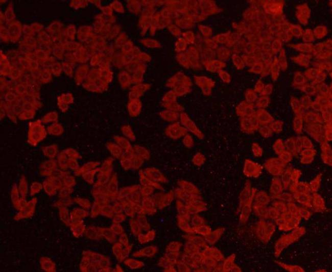 AKT1 Antibody in Immunocytochemistry (ICC/IF)