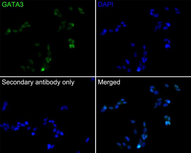 GATA3 Antibody in Immunocytochemistry (ICC/IF)