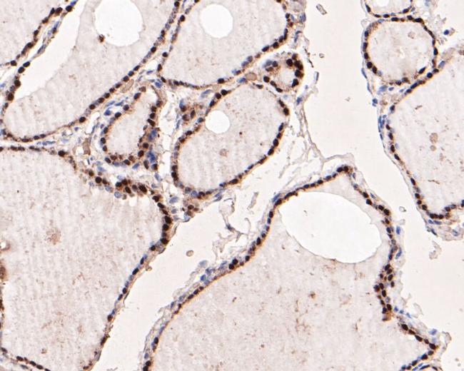 PAX8 Antibody in Immunohistochemistry (Paraffin) (IHC (P))