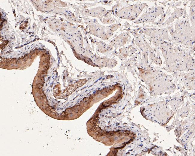 COX2 Antibody in Immunohistochemistry (Paraffin) (IHC (P))