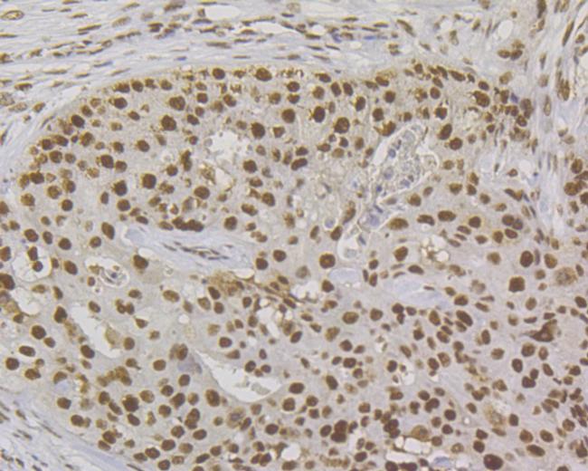 MSH2 Antibody in Immunohistochemistry (Paraffin) (IHC (P))