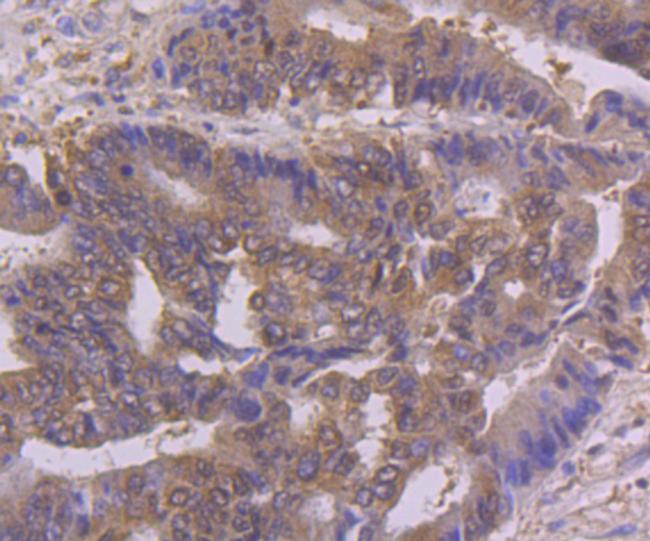 NFIB Antibody in Immunohistochemistry (Paraffin) (IHC (P))