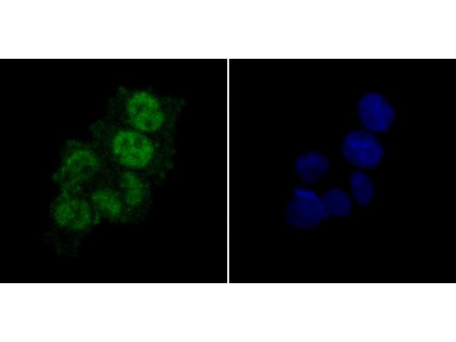 PTBP1 Antibody in Immunocytochemistry (ICC/IF)