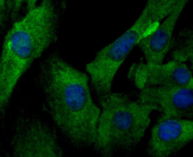 IL-6 Antibody in Immunocytochemistry (ICC/IF)