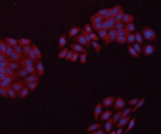 GAPDH Antibody in Immunocytochemistry (ICC/IF)