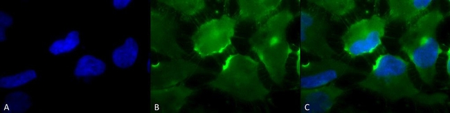 CD74 Antibody in Immunocytochemistry (ICC/IF)