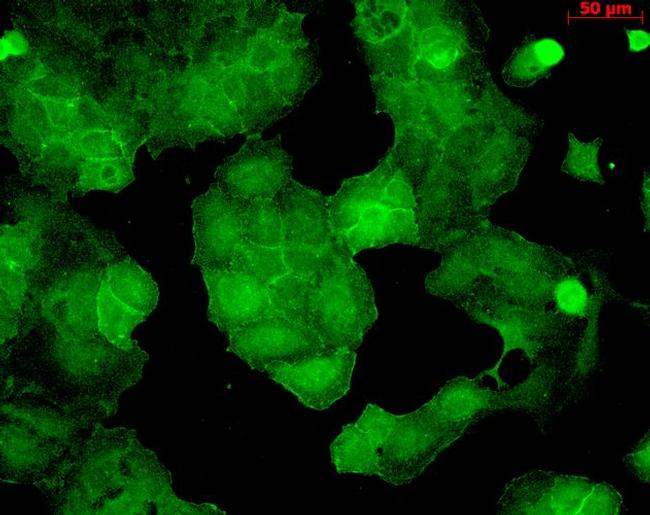 PSD-95 Antibody in Immunocytochemistry (ICC/IF)