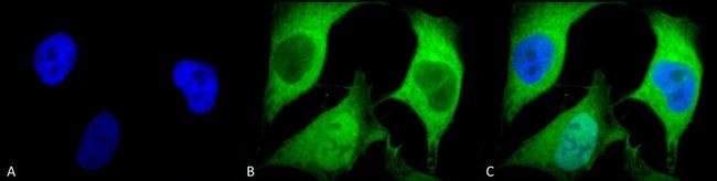 Ubiquitin Antibody in Immunocytochemistry (ICC/IF)