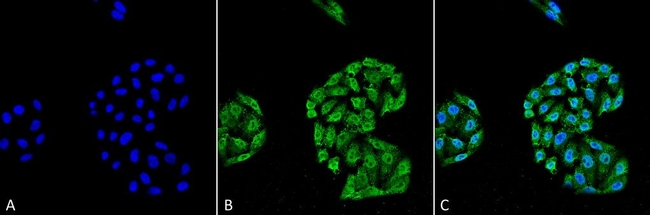 HSP70 Antibody in Immunocytochemistry (ICC/IF)