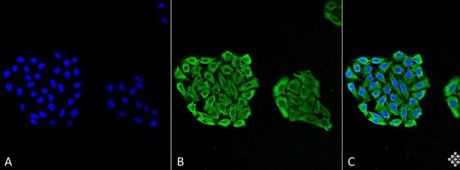 HSP70 Antibody in Immunocytochemistry (ICC/IF)