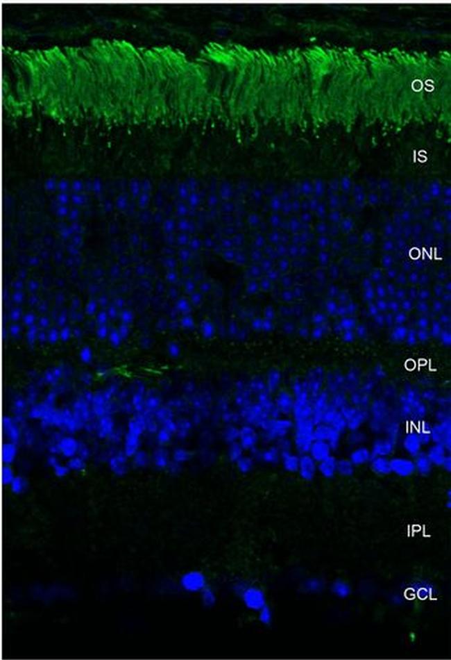 Rhodopsin Antibody in Immunohistochemistry (IHC)