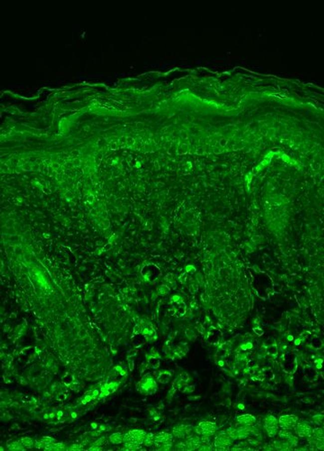 Rhodopsin Antibody in Immunohistochemistry (Paraffin) (IHC (P))