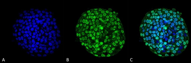 CENPA Antibody in Immunocytochemistry (ICC/IF)