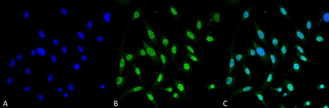 GRP78 Antibody in Immunocytochemistry (ICC/IF)