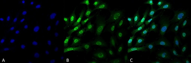 Ubiquitin Antibody in Immunocytochemistry (ICC/IF)