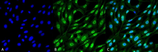 Ubiquitin Antibody in Immunocytochemistry (ICC/IF)