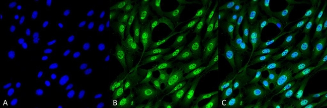 Ubiquitin Antibody in Immunocytochemistry (ICC/IF)