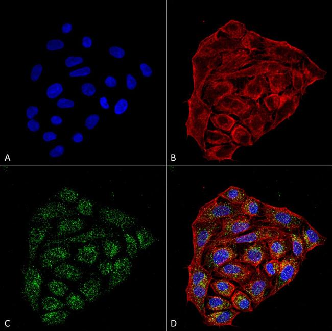 CD74 Antibody in Immunocytochemistry (ICC/IF)