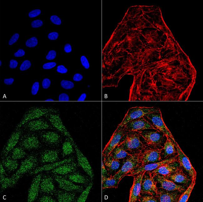 CD74 Antibody in Immunocytochemistry (ICC/IF)